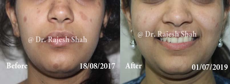 lifeforce homeopathy case-photos